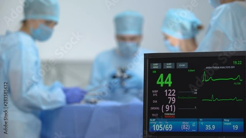 Heart rate falling on ecg monitor during surgery operation, reanimation, death photo