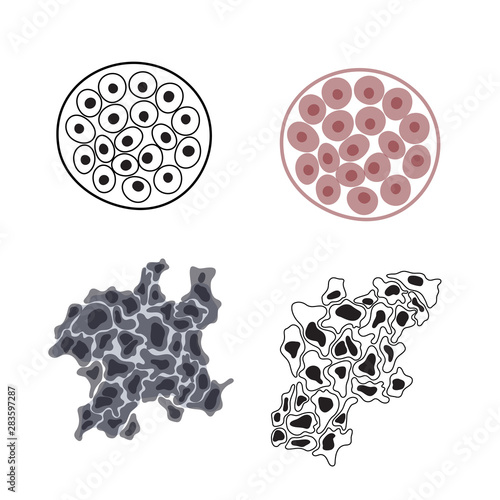 Vector  illustration of malignant and benign tumor
