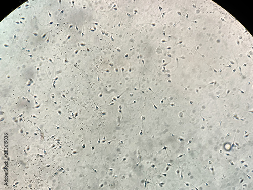 View at human sperm under microscope in lab