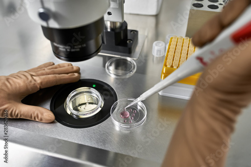 Process of in vitro fertilization in laboratory photo
