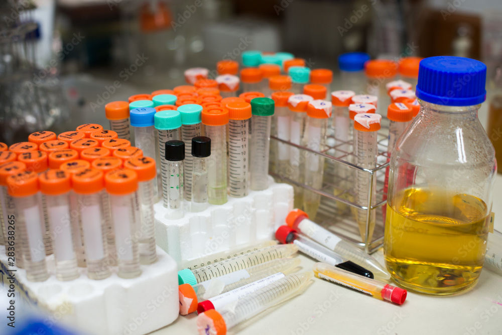laboratory equipment pipette dropping sample into a test tube,abstract science background. laboratory equipment pipette dropping sample into a test tube,abstract science background.