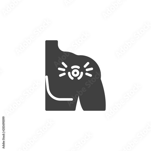 Shoulder joint pain vector icon. filled flat sign for mobile concept and web design. shoulder injury glyph icon. Symbol, logo illustration. Vector graphics