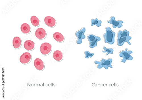 cell structure: normal and cancer