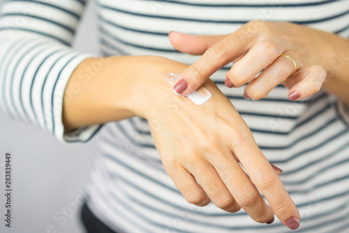 A woman applying scar removal cream to healed the cooking oil burn scar on a her hands. Healing, Removal, Hot oil burn treatment, Vitamin E, Scars care, Skin care products, Medical cream.