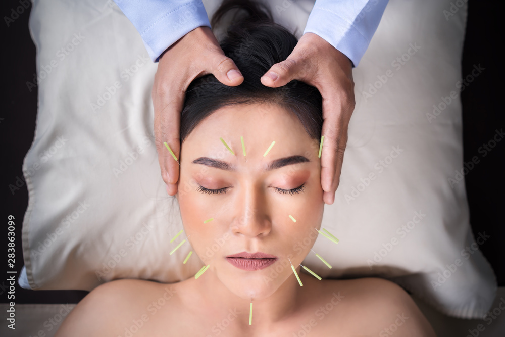 woman undergoing acupuncture treatment on face - obrazy, fototapety, plakaty 