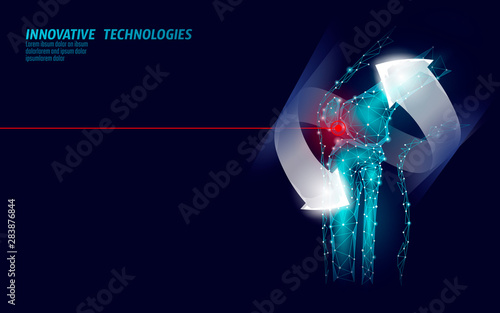 Human knee joint 3d model vector illustration. Low poly design future technology cure pain treatment. Recovery cure glowing arrow gel medicine vector illustration photo
