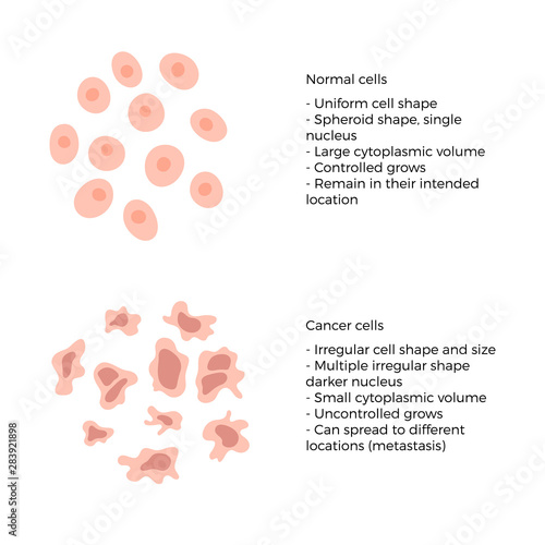 cell structure: normal and cancer