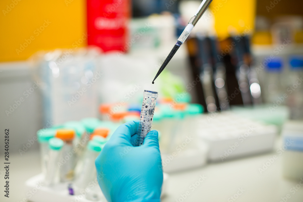 Lab technician blood group test,malaria test Lab technician blood group test,malaria test