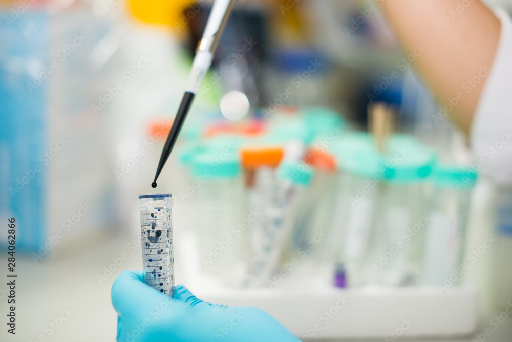 laboratory technician blood group test,malaria test laboratory technician blood group test,malaria test