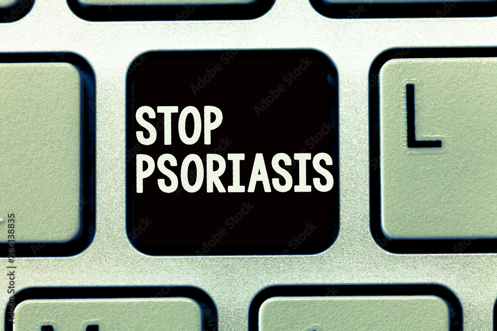 Writing note showing Stop Psoriasis. Business photo showcasing End the disorder that causes the rapid buildup of skin cells. Writing note showing Stop Psoriasis. Business photo showcasing End the disorder that causes the rapid buildup of skin cells.