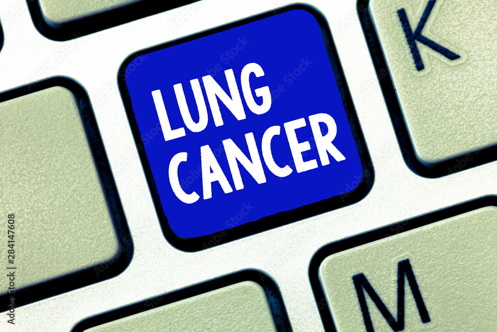 Text sign showing Lung Cancer. Conceptual photo Uncontrolled growth of abnormal cells that start in the lungs. Text sign showing Lung Cancer. Conceptual photo Uncontrolled growth of abnormal cells that start in the lungs.