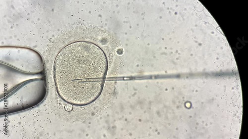 View through microscope at in vitro fertilization process