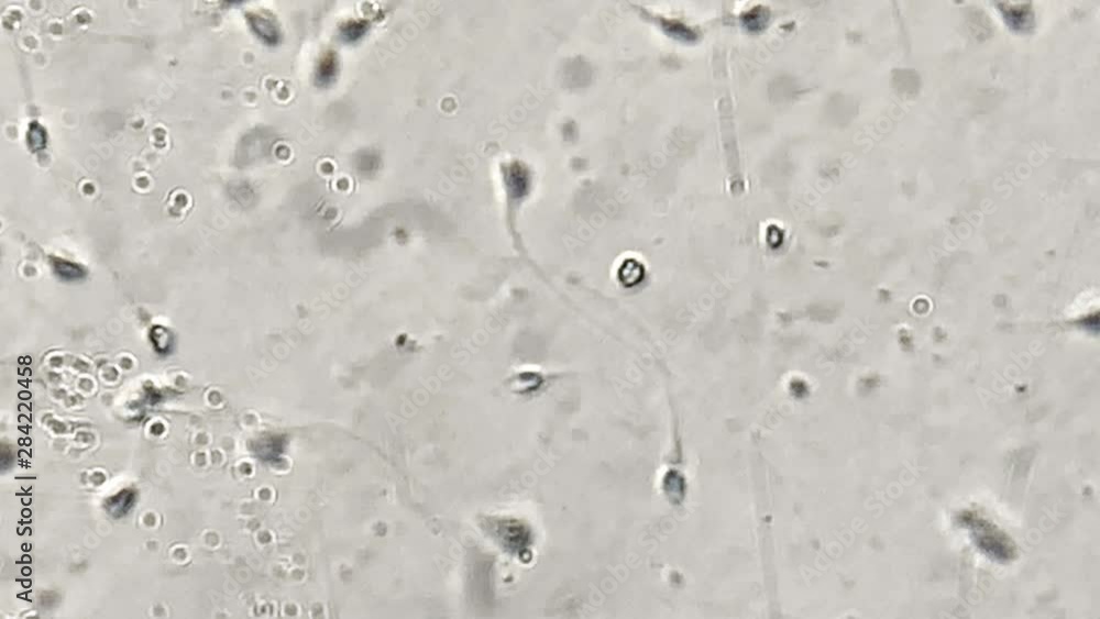 View at human sperm under microscope in lab View at human sperm under microscope in lab