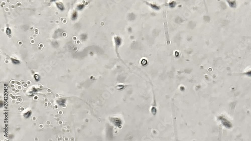 View at human sperm under microscope in lab