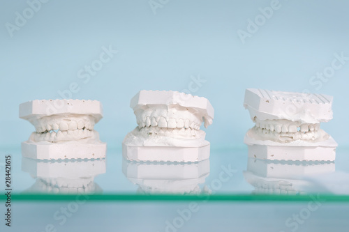 Different gypsum human jews model on glass shelf at dentist office on light blue background. Dentistry and prosthetic laboratory. Casting for bracket and prosthesis implant form photo