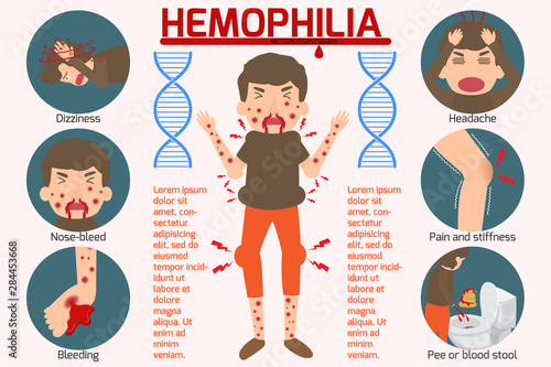 Hemophilia symptom Infographics elements. Sign and Symbols of Hemophilia. Health and Medical concept. Vector cartoon illustration isolated.