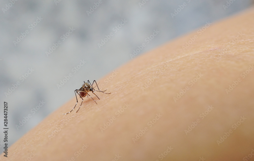 Mosquito sucking blood on human skin cause sick, Malaria,Dengue,Chikungunya,Mayaro fever,Dangerous Zica virus,influenza,Zika virus Mosquito sucking blood on human skin cause sick, Malaria,Dengue,Chikungunya,Mayaro fever,Dangerous Zica virus,influenza,Zika virus