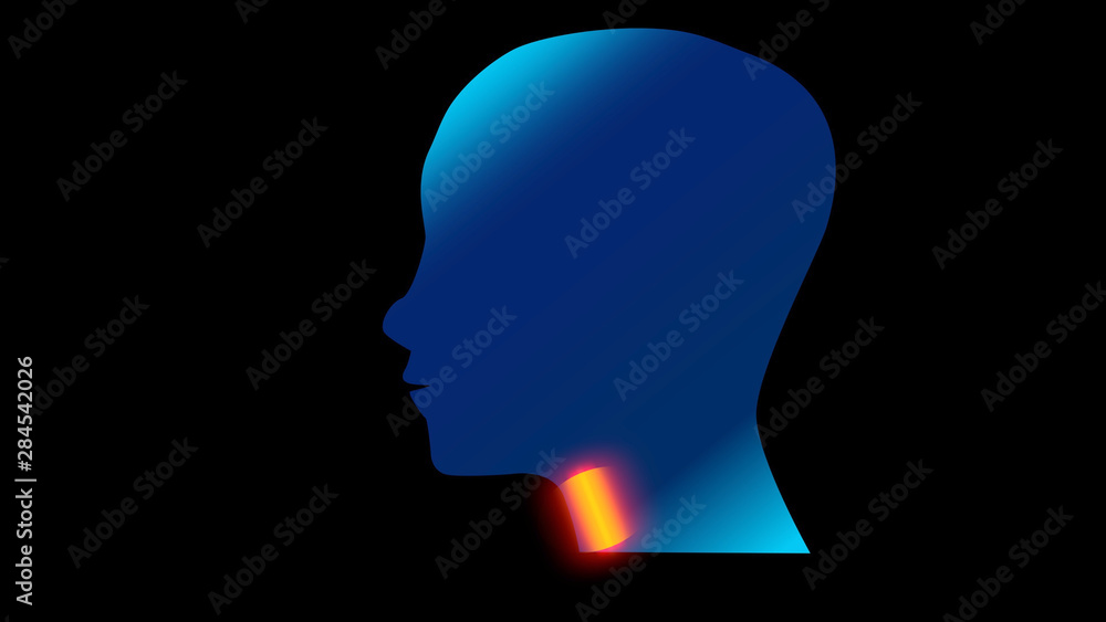 Sore Throat side Profile Silhouettes with Ache Locations. Adult and children feel Pain in Throat, design illustration. Sore Throat side Profile Silhouettes with Ache Locations. Adult and children feel Pain in Throat, design illustration.