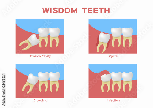 wisdom teeth vector