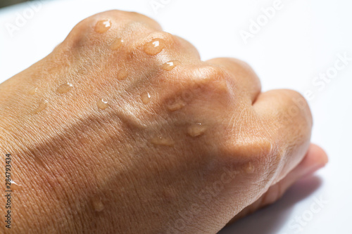 Woman s wet back hand with water drops on white acrylic background  Close up   Macro shot  Selective focus  Asian Body skin part   Relaxing Bath  Healthcare concept