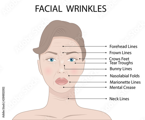 Illustration of Common Types of Facial Wrinkles, cosmetic surgery, woman facial treatment concept