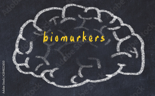 Drawind of human brain on chalkboard with inscription biomarkers photo
