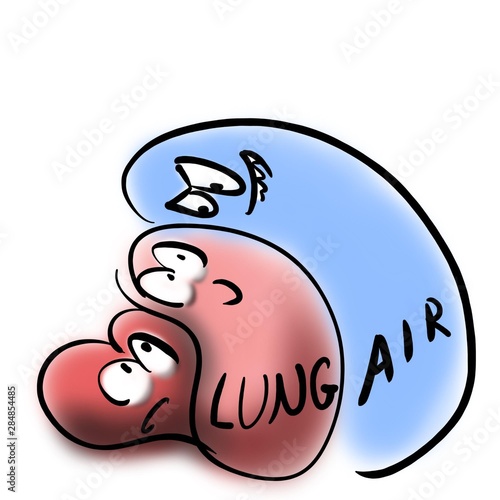 Pneumothorax compresses the lung and heart