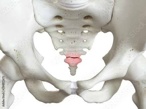 Cuadro en lienzo 3d rendered medically accurate illustration of a broken coccyx