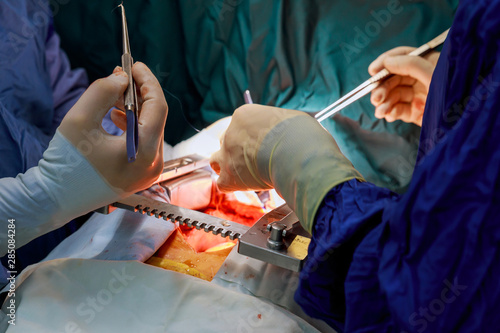 Surgeon operating team operating heart.