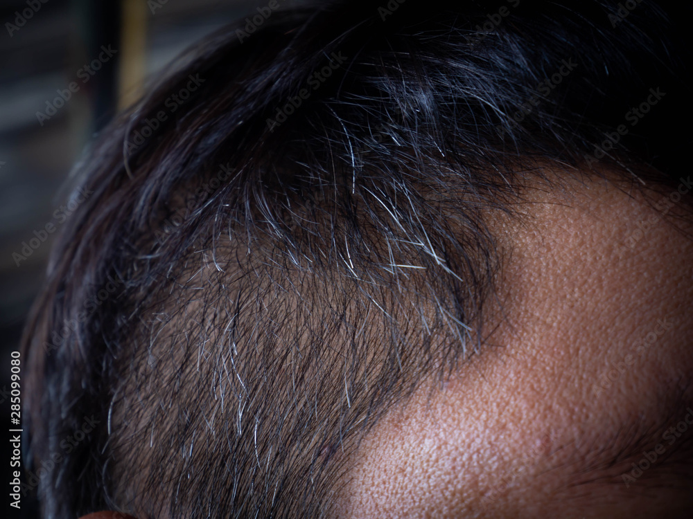 Obraz premium Short hair and grey hai
