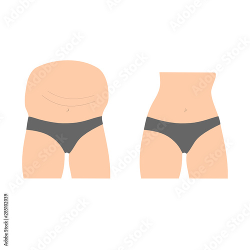 woman in underwear