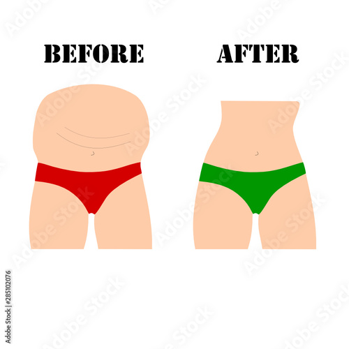 fat and slim woman body transformation. Slimming vector. woman body with pants.