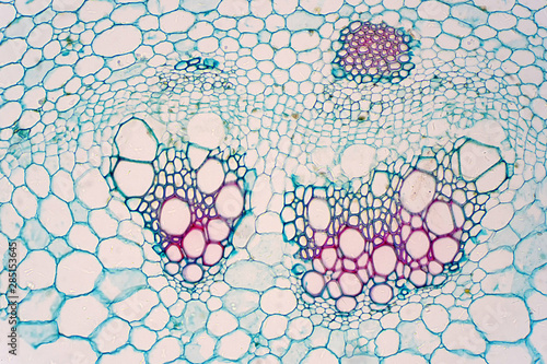Cross sections of plants stem show plant vascular tissue under microscope view.