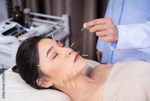 woman undergoing acupuncture treatment on face
