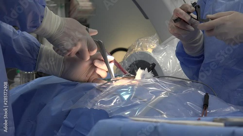 Minimally invasive surgeries encompass surgical techniques that limit the size of incisions needed and so lessen wound healing time, associated pain and risk of infection.