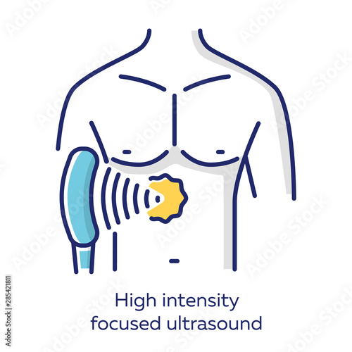 High intensity focused ultrasound white color icon. HIFU. Non-invasive therapeutic technique. Treatment by ultrasonic waves. Destroying tissue by intense heat. Isolated vector illustration