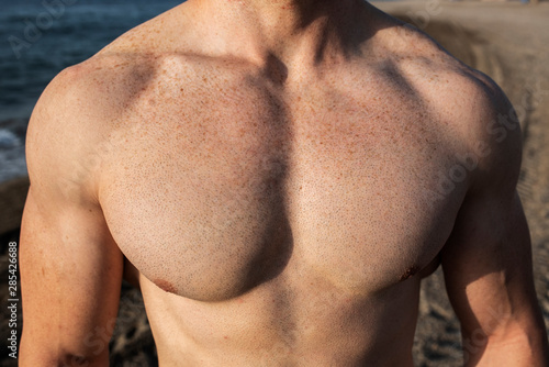 chest skin with spots, freckles and moles due to the sun