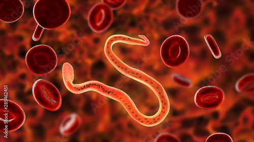 Wuchereria bancrofti, a roundworm nematode, one of the causative agents of lymphatic filariasis, 3D illustration showing presence of sheath around the worm and tail niclei non-extending to tip photo