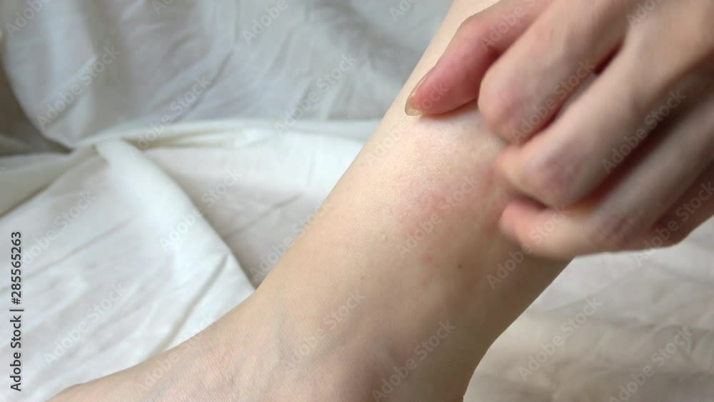 足首を掻く女性 4K Closeup shot of a young woman scratching her ankle 足首を掻く女性 4K Closeup shot of a young woman scratching her ankle