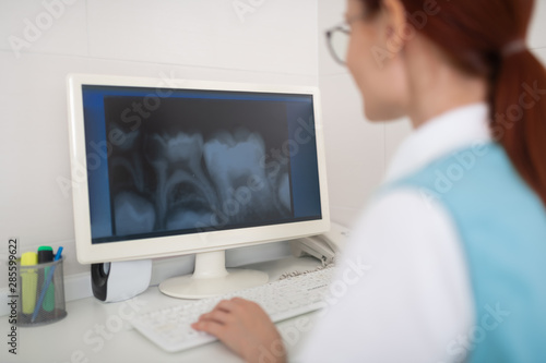 Close up of dentist sitting near computer and studying X-ray