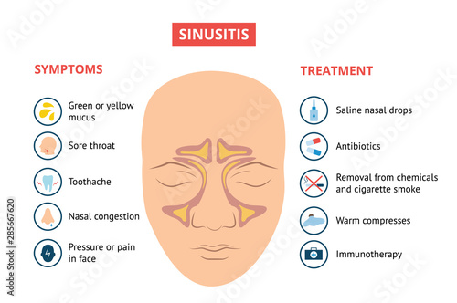 Respiratory sinusitis symptoms and treatment medical banner vector illustration. photo