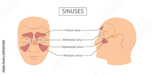 Sinusitis pus in nasal cavity disease varieties and names vector illustration.