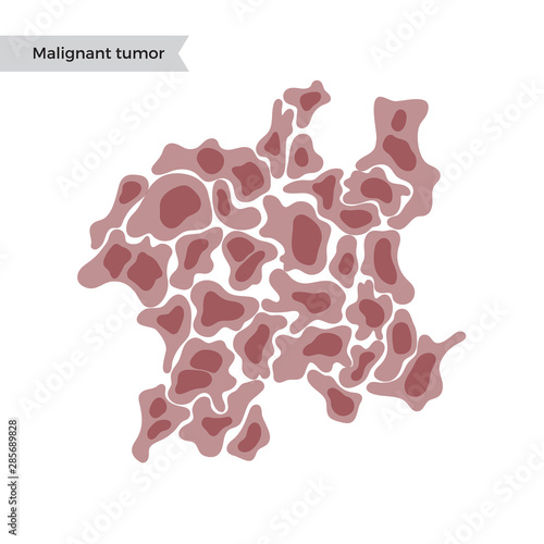 Vector isolated illustration of malignant tumor photo