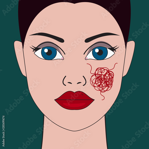 woman with dilated vessels on face