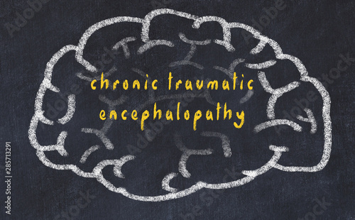 Drawind of human brain on chalkboard with inscription chronic traumatic encephalopathy photo