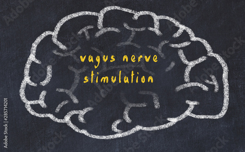 Drawind of human brain on chalkboard with inscription vagus nerve stimulation photo