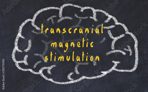 Drawind of human brain on chalkboard with inscription transcranial magnetic stimulation photo