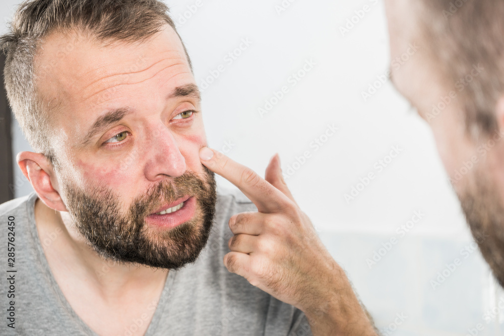 Obraz premium Man looking at wrinkles on his face