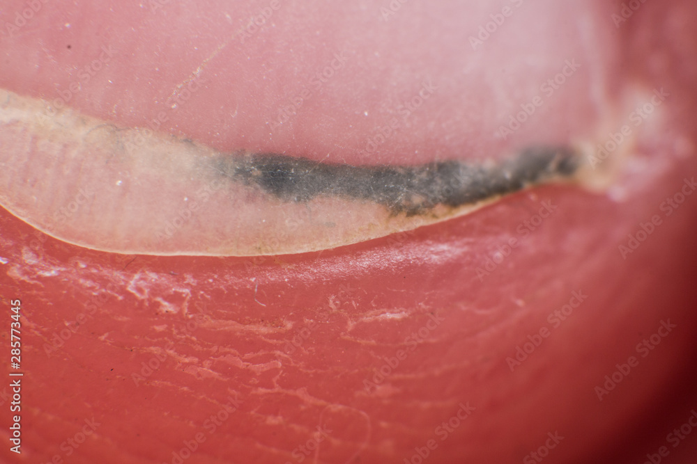 Fototapeta premium Dirt stuck under the man nail super macro