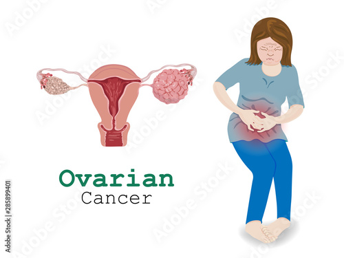 Woman pain with Ovarian Cancer.
